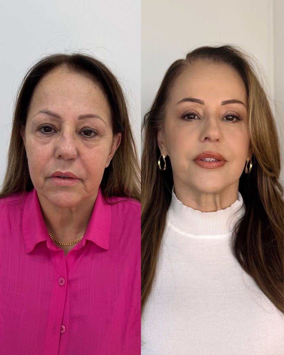 Antes e depois - transformação facial