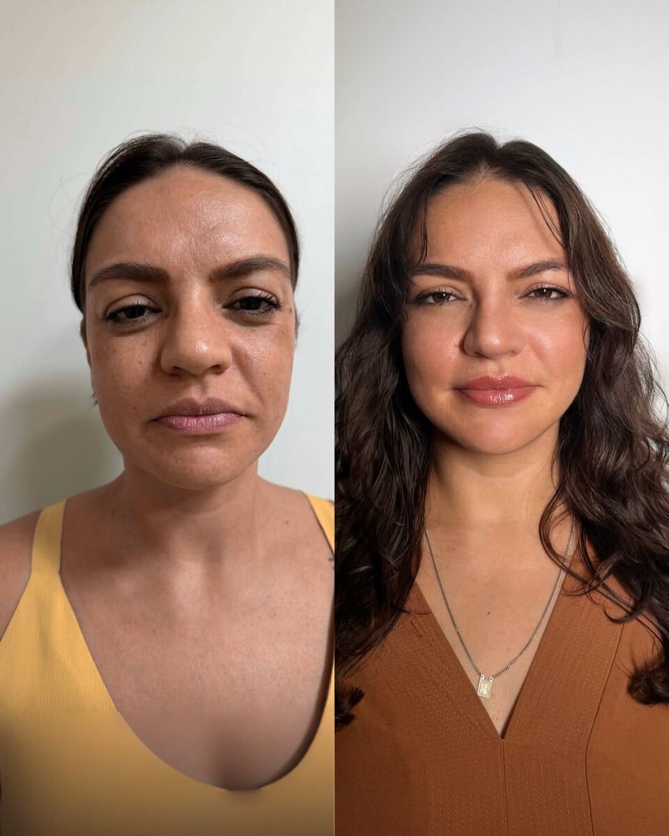 Antes e depois - transformação facial